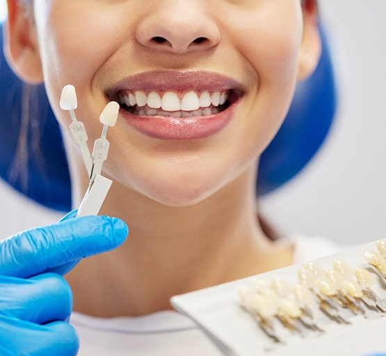 Nose-to-neck view of woman smiling as dentist tries to find a color match for veneers