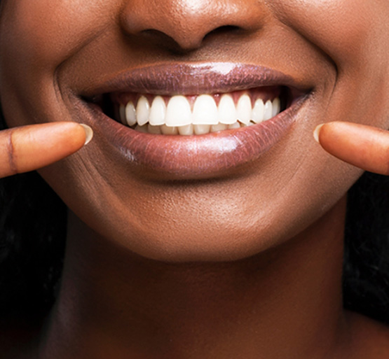 Closeup of woman pointing to her beautiful smile