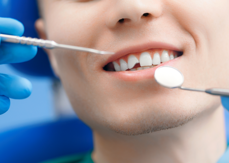 Man with chipped tooth at dentist
